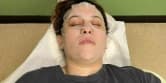 IPL Skin Rejuvenation Facial