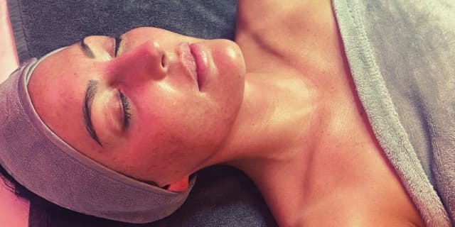 Acne Facial