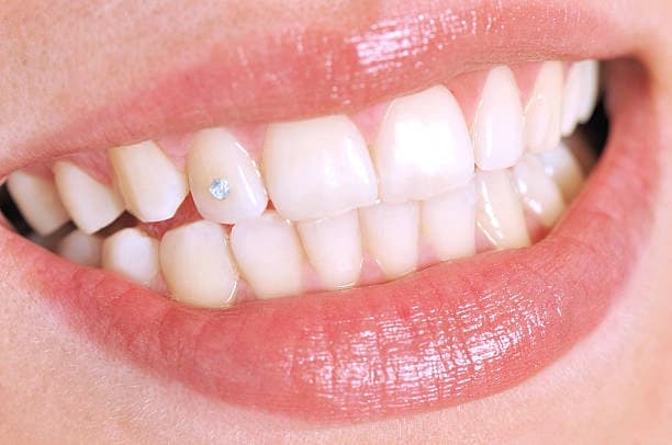 One Swarovski Crystal Tooth Gem
