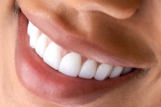 Three 45-Minute Standard Teeth Whitening Treatments for One Person