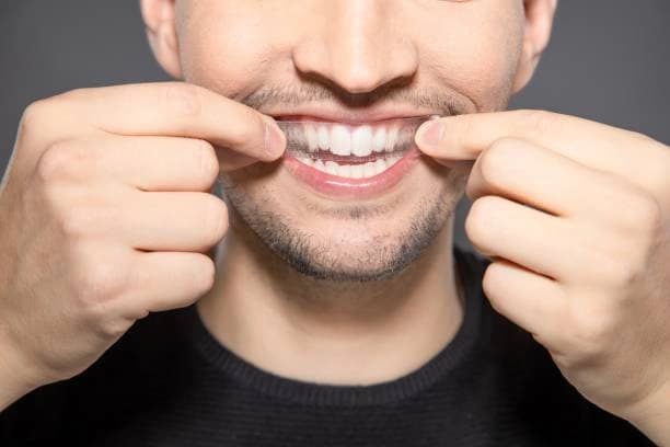 35-Minute Advanced Teeth Whitening Treatment