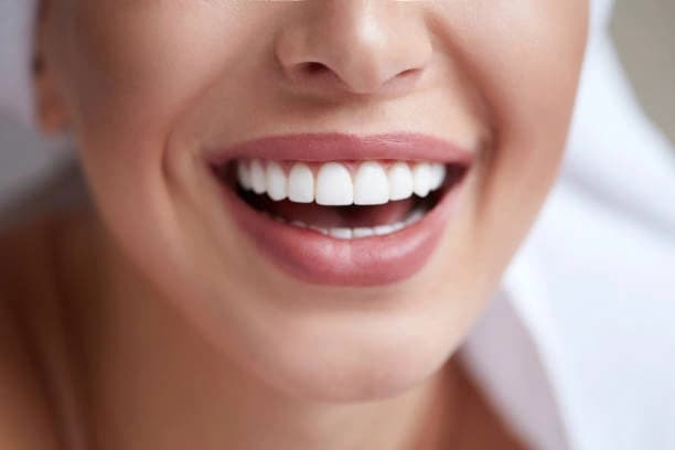 45-Minute Standard Teeth Whitening Treatment for Two People