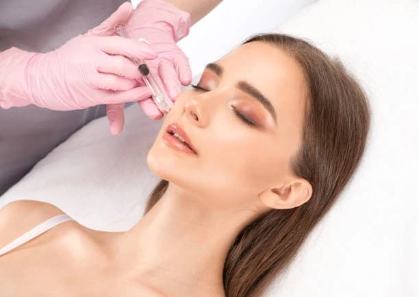Fox Eye Brow Lift with PDO Threads - Four Barbed Threads used for Brow Lift