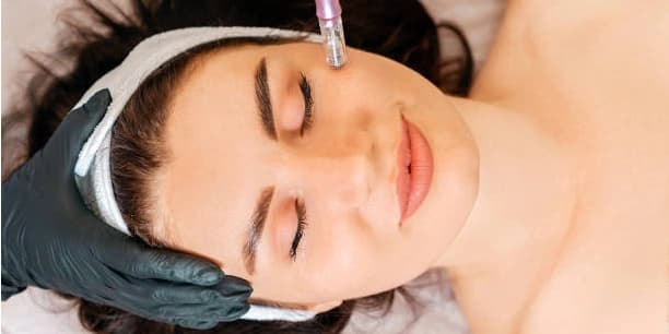 One Microneedling Treatment for Face