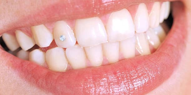 2 Tooth Gems