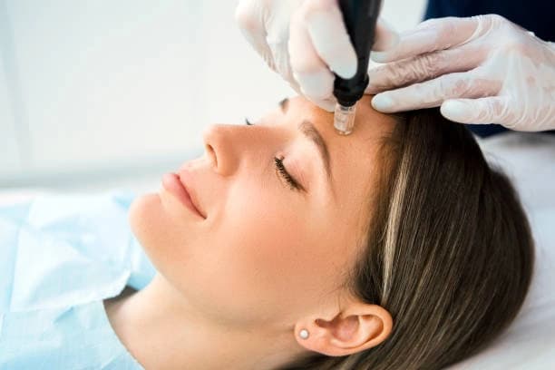 Two Micro Needling Treatments