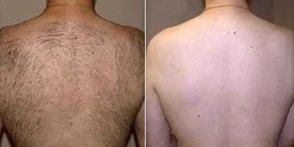 Back Wax