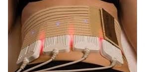 Cellulite Removal