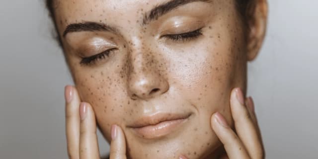 Microneedling