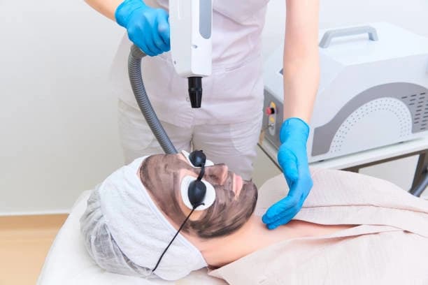Two Therma Lift Skin-Tightening Facelifts