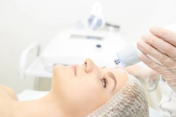 Three Ultra Lift Face Lift Sessions