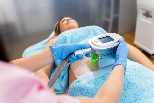 FAT FREEZING - 1 Session for 1 Area using 1 or 2 Applicators (Abdomen, Arms, Thighs, Back/Love Handles)