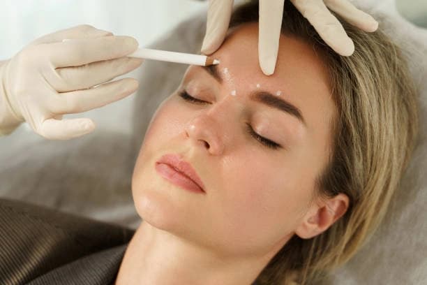 Botox/Xeomin/Juveau - 60 Units