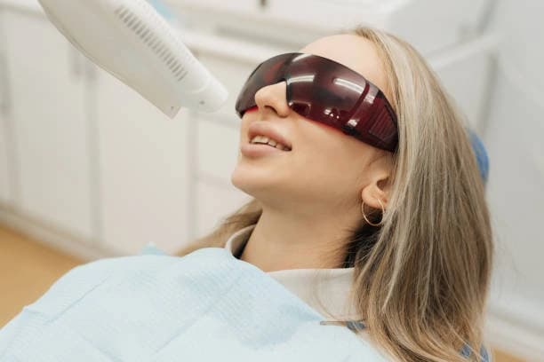 Cyber Monday Deal: Single Teeth Whitening Treatment