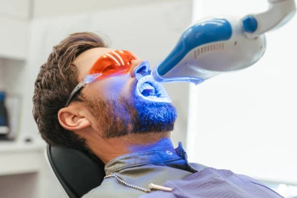 Teeth Whitening for 60 Minutes