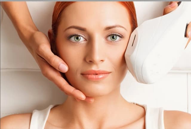 IPL Photofacial