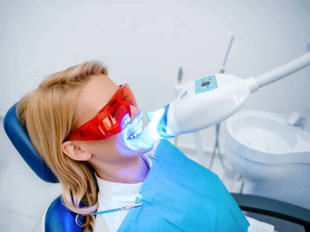 Teeth Whitening for 30 Minutes