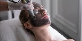 Carbon Laser Facial