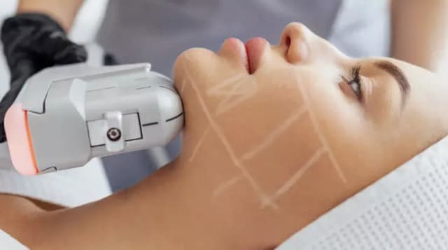 Large - ULTherapy
