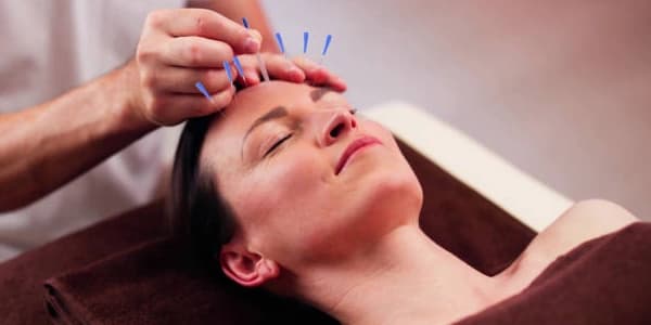 90 Minute Cosmetic Facial Acupuncture