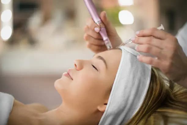 One Microneedling Treatment