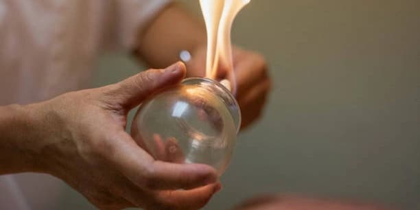 Fire Cupping