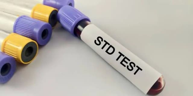 Basic STD Panel