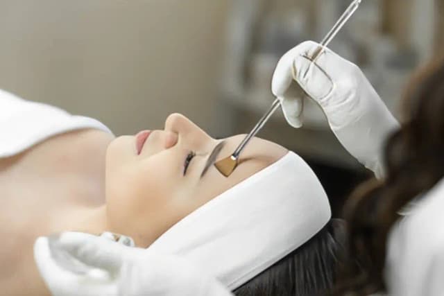 One Chemical Peel