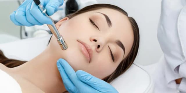 Diamond Microdermabrasion