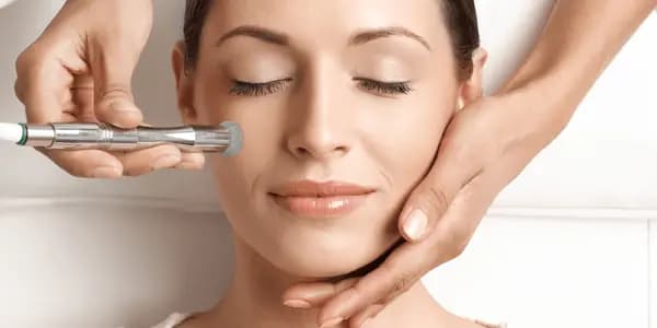 Deep Layer Exfoliation with Microdermabrasion
