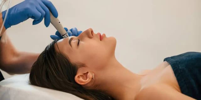 Microneedling Face - 1 Session