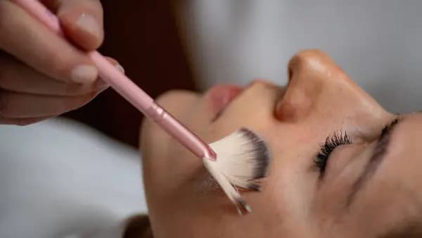 Chemical Peel - Light