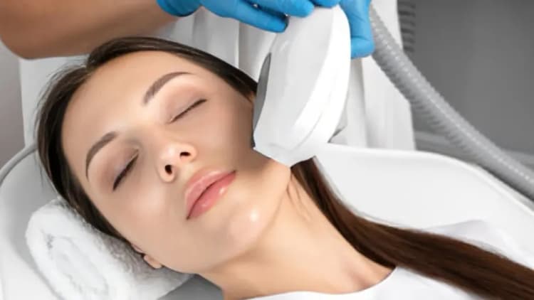 Vein Removal - Face