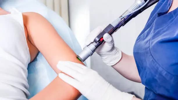 IPL - Upper Arms